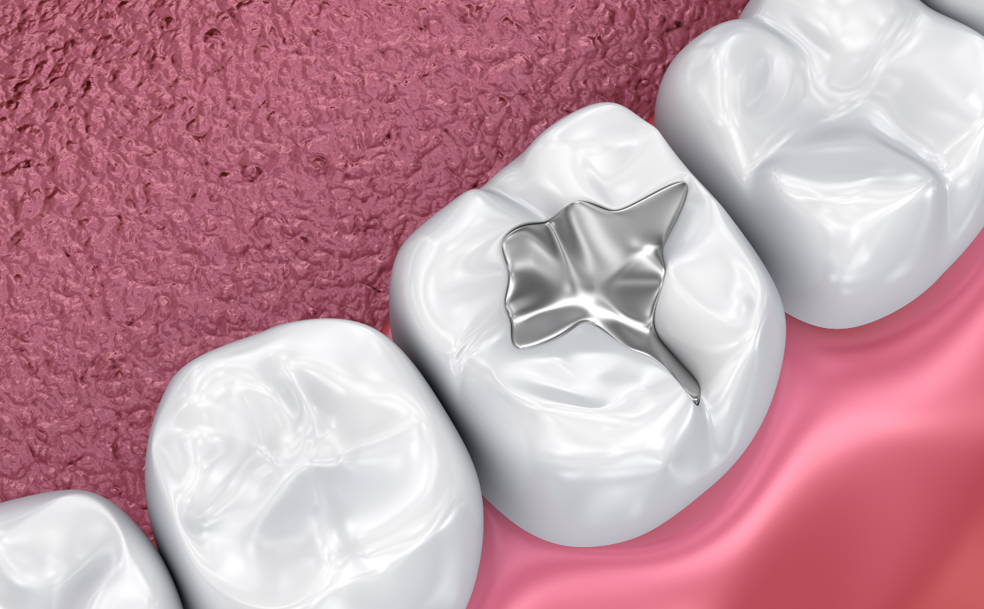 mercury_free_dentist_Milton-Freewater